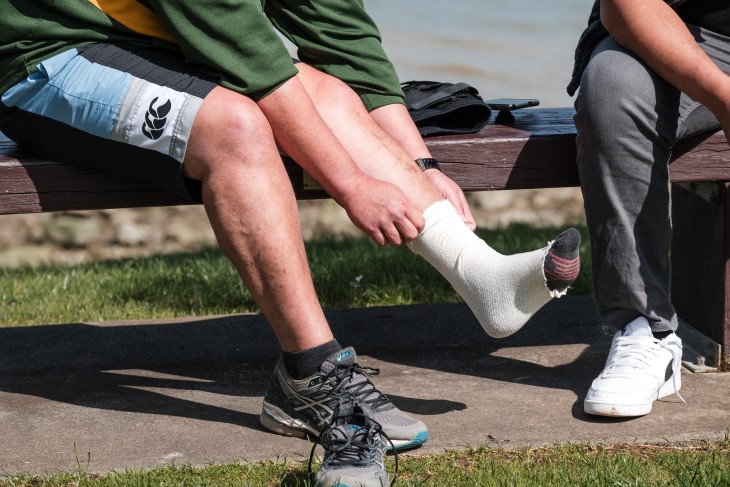 A close-up photo of Taane Karena's injured leg, showing his scars and a support bandage.